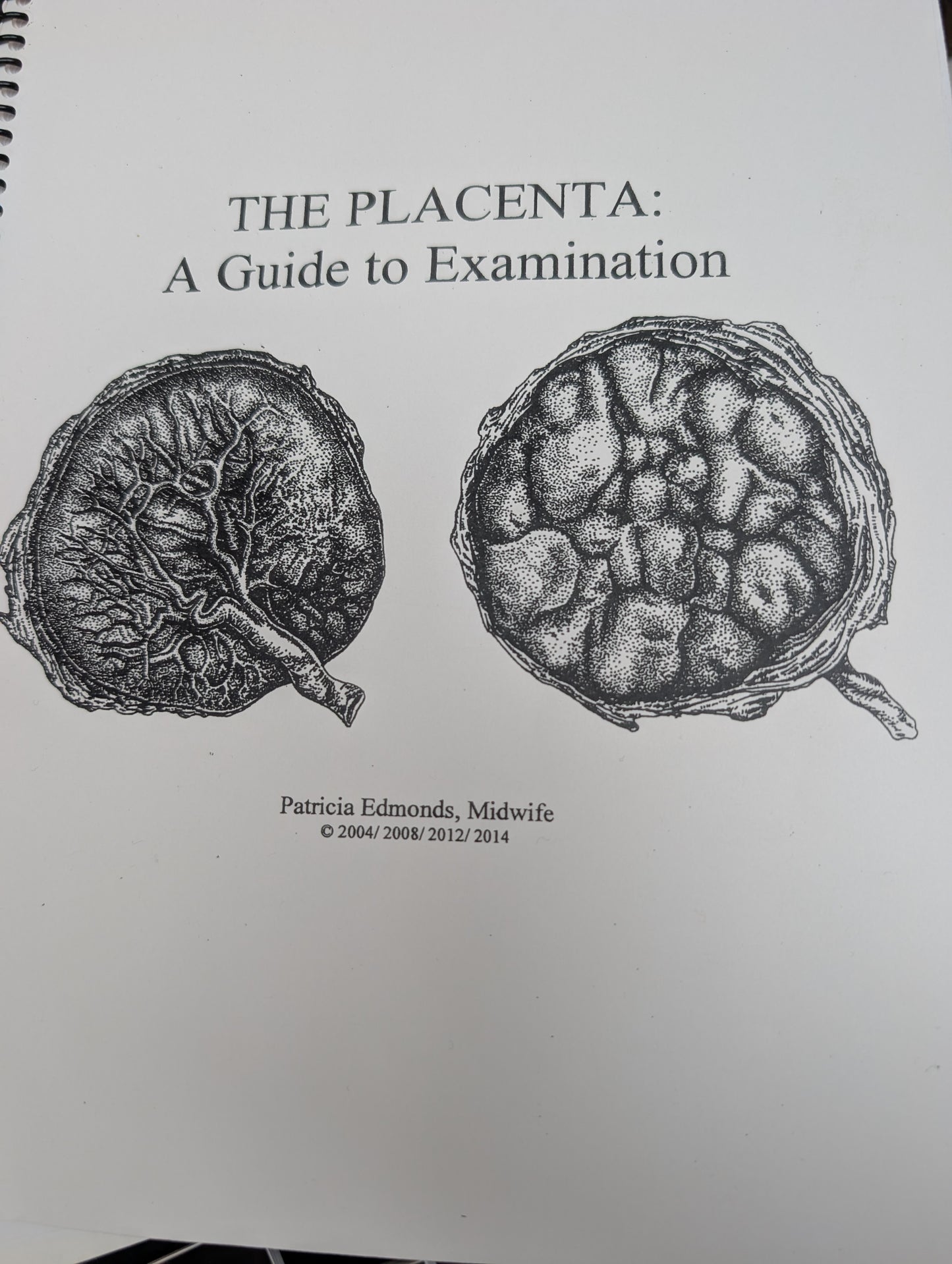 The Placenta, A Guide to Examination *PRE-ORDER*