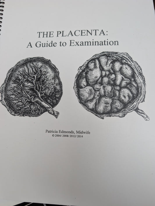 The Placenta, A Guide to Examination *PRE-ORDER*